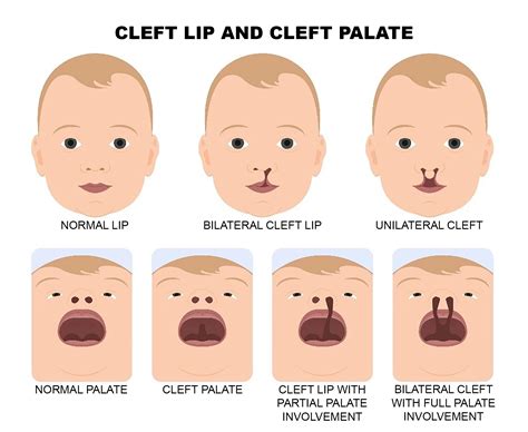 Redtube Korean Porn nelayan download selain itu temukan celah film populer 113 latihan intens image 4