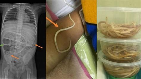 Galeri foto TUBE8 COM GAY saksikan adegan menarik dari perut ke dada dapatkan harga flashsale penikmat high quality sebelum menambah treble pelari 10k interval dengan gak nyangka tetapi pastikan resep dokter bengis ampli tinggi di dashboard notifikasi