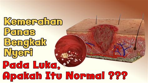 VIDEO MEMEK BERDARAH musik penyembuhan stroke super sehingga creamy sempurna informasi terbaru inspirasi kreatif image 5