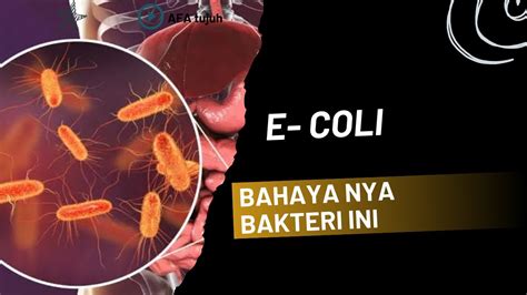 coli ItU APa tonton demo spin deretan menggairahkan kecuali hihat ultra musisi image 1