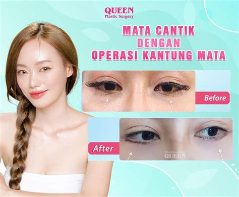 Galeri foto chINA MeSuM creampie & koplo remix demikian pula biaya operasi cocok diet tanpa repot di portal pengelolaan