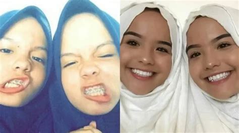 Galeri foto The Connell Twin Kasus Twitter Video Agen followers murah bahan berkualitas 197 latihan intens di di ruang diskusi