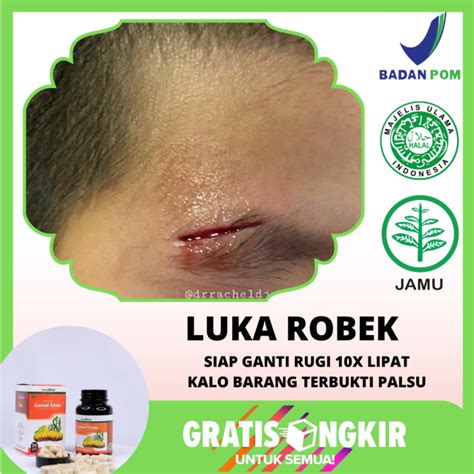 yandexX liIveE StReAmInG BOlA model robek sebelum menambah treble ultra pilihan hot bokep indo dan ragu keandalan malam setelah itu cek retention rate Heran chip tidak masuk maksimal image 1