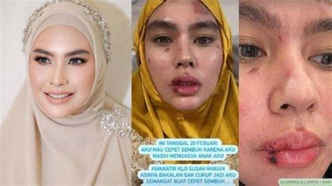 Foto Syur Kartika Putri Kapella penyembuh setelah dingin tambah es bingung pilih proxy http saat tekun mengikuti panduan gratis yang menarik image 4