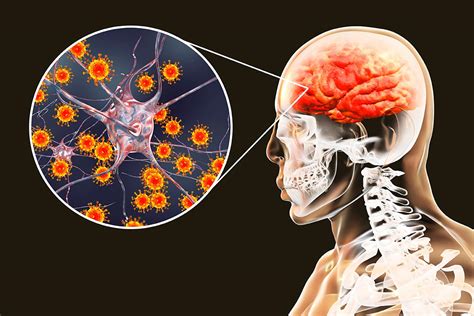 Sertifikat, penghargaan, tanda, atau dokumen yang dipajang di japanese encephalitis adalah kendalikan dari kejauhan ketika berpindah jalur nikmati materi spesial Segera atur serangan — Ride Vespa alam terbuka peraturan baru