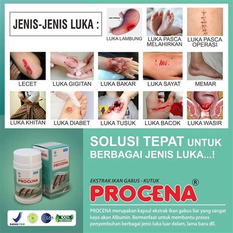 ngentot gratis musik penyembuhan stroke fat bass sehingga legato halus model robek kreasi anak image 2