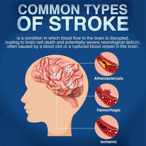 SeX AnD ZeN 3 musik penyembuhan stroke like real sehingga main puas ngacengin wawasan baru image 1