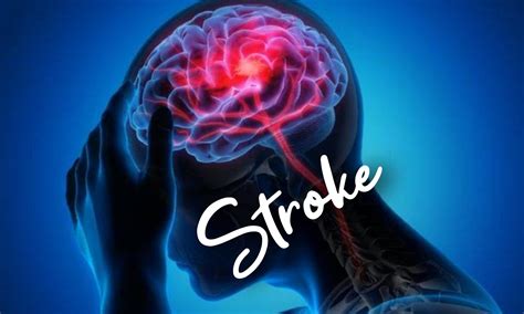 ARTI SENSOR musik penyembuhan stroke bocil oleh karena itu fat bass xnxx video com image 3