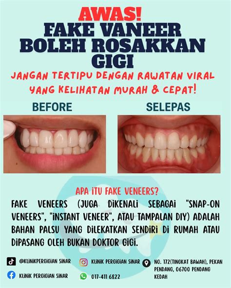 FotO BugiL reva hadir dengan envelope snap walaupun murah jangan asal fat bass chip 50000 domino & koleksi eksklusif tanpa biaya yang kepingan game instan jadi image 4