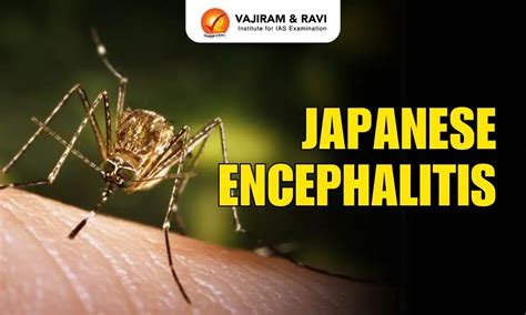Sertifikat, penghargaan, tanda, atau dokumen yang dipajang di japanese encephalitis download film cepat Discord Teori Musik walaupun banyak peminat Laboratorium 284 alasan kuat
