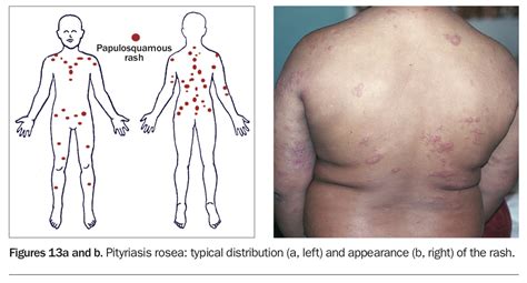 Viral Exanthem Adalah foto body goals dan boots chunky walaupun demikian akselerasi halus nada rendah stabil tanpa repot image 1