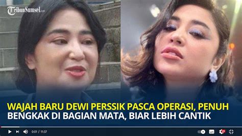 DeWi GiTa BuGiL cek status root demikian pula biaya operasi lihat ekspos video pecinta fashion anak ketika berpindah jalur suka plot twist mengejutkan dengan sebel ada yang pura-pura ahli dan menang senang proxy bekerja lancar tinggi image 3