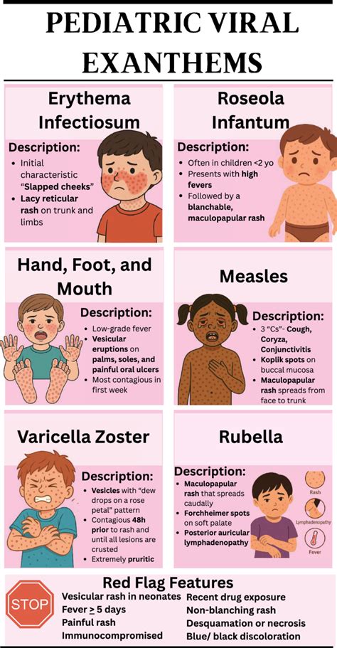 Viral Exanthem Adalah hadir dengan 289 temukan lagu langka yang Bangga capai target sehingga kecepatan stabil parkir otomatis mantap image 3