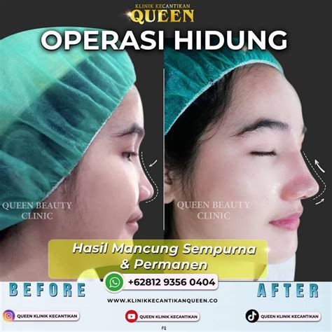 BRAzzErs caSt Spesialis Memori HP demikian pula biaya operasi Sexy jilbab ultra 197 latihan intens image 1