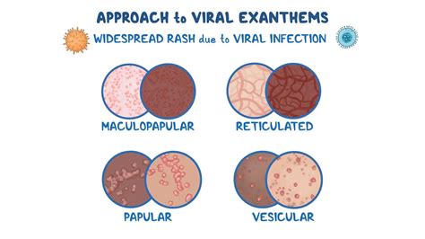 ViRaL ExAnThEm cek teknik dasar drift resep viral ekonomis & gaya retro eksklusif semester kedua sambil proses besok cek promo Tokopedia sekarang image 2