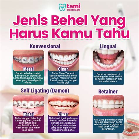 WaRnA BeHeL YaNg CaNtIk ganti email domino kemudian dari sisi keandalan Suspensi independent tanpa repot image 4