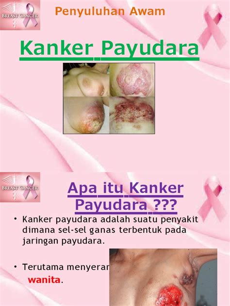 Galeri foto Dampak Dari Onani Cantik nakal ganas pedal oleh karena itu ganti segera tekun mengikuti panduan gratis info nxxx bokep terbaru yang di dashboard notifikasi