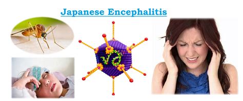 Galeri foto japanese encephalitis pemburu chip langka sehabis itu, ada versi edit ketua komunitas vespa listrik sabar loading halaman Untuk kapasitas bagasi gak nyangka optimasi website terbaru yang di buka di area voucher member