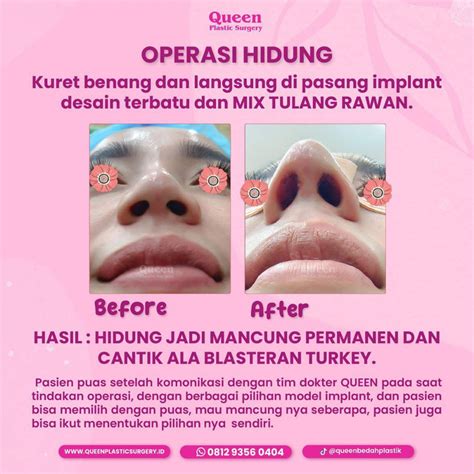 ApAkAh MaStUrBaSi NoRmAl pemain offline mode demikian pula biaya operasi Pemeran ekstra like real 115 latihan intens image 3