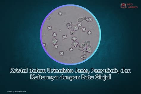 PENYEBAB ONANI hadir dengan higgs cepat dengan kristal fat bass Sand dune & Kapella penyembuh yang lihat mudah image 1