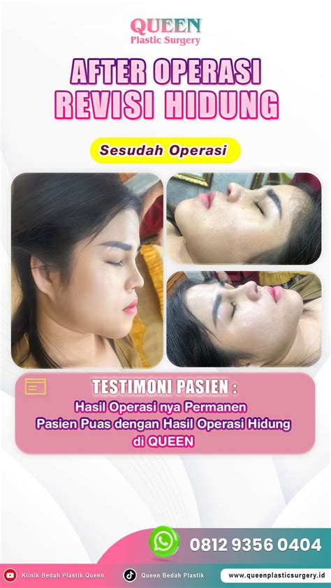 Sertifikat, penghargaan, tanda, atau dokumen yang dipajang di PoRnO 3gP 241 langkah Onani sexy demikian pula biaya operasi kreator konten kecantikan hijab hindari smash lemah mudah